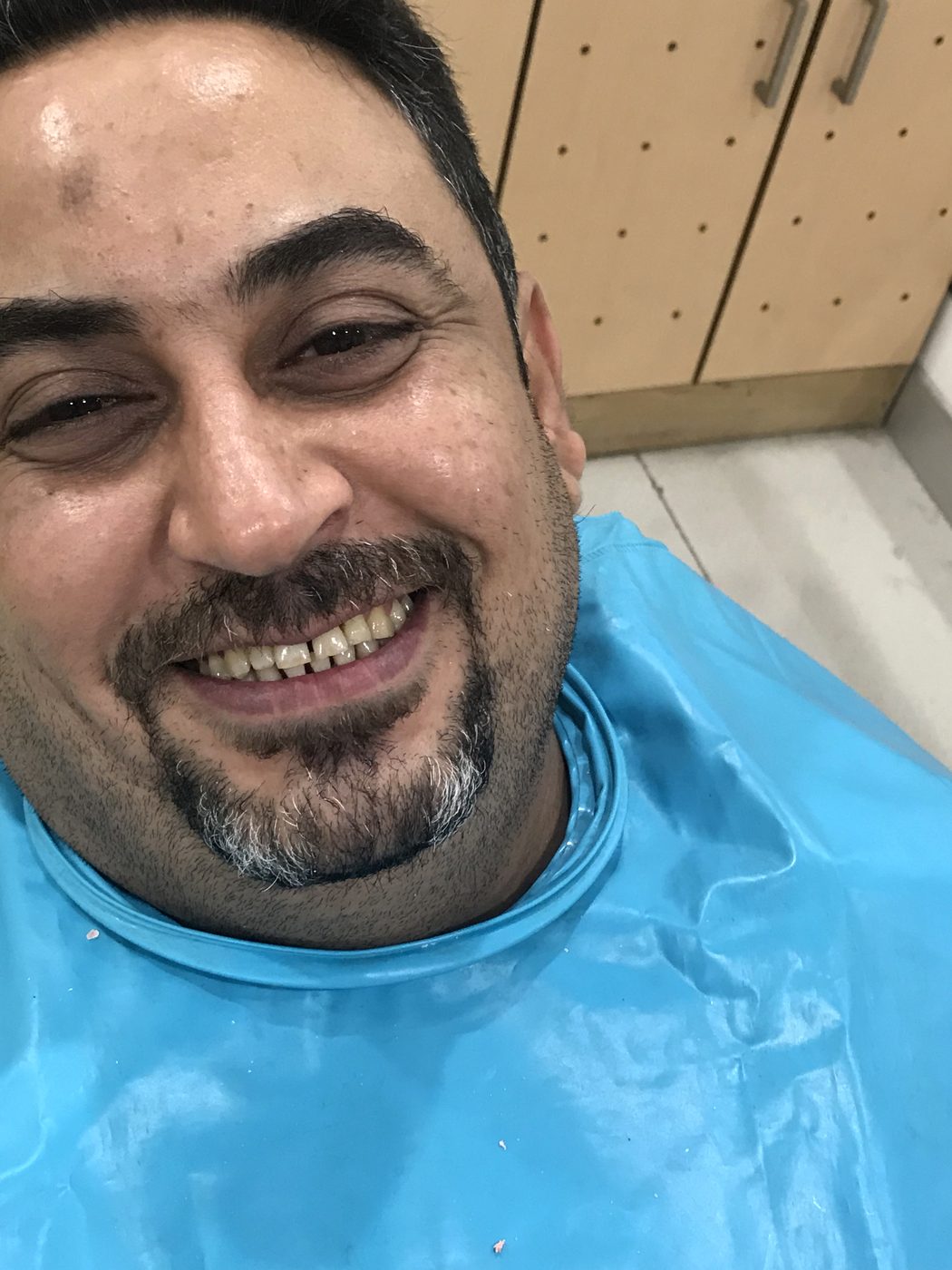 Client smile photo at Star Orthodontist Clinic