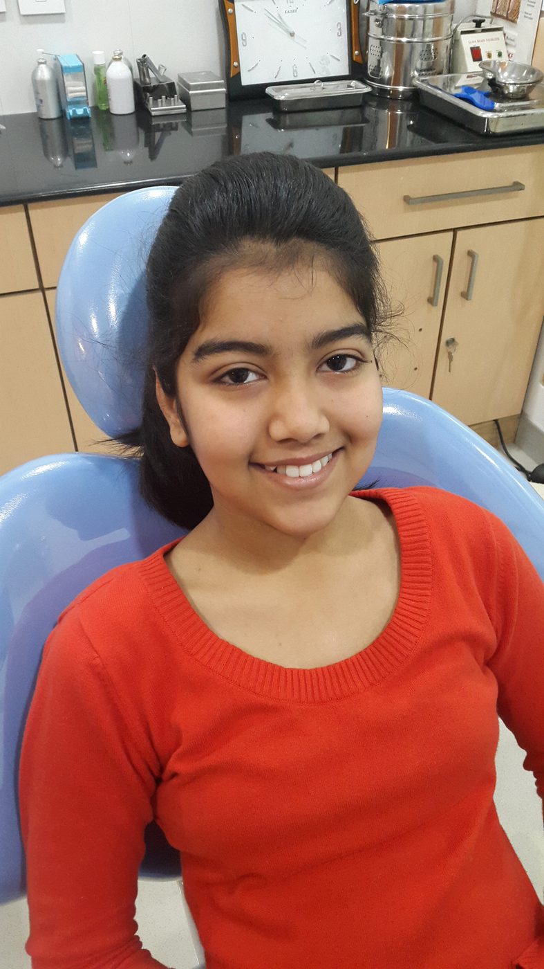 Client smile photo at Star Orthodontist Clinic