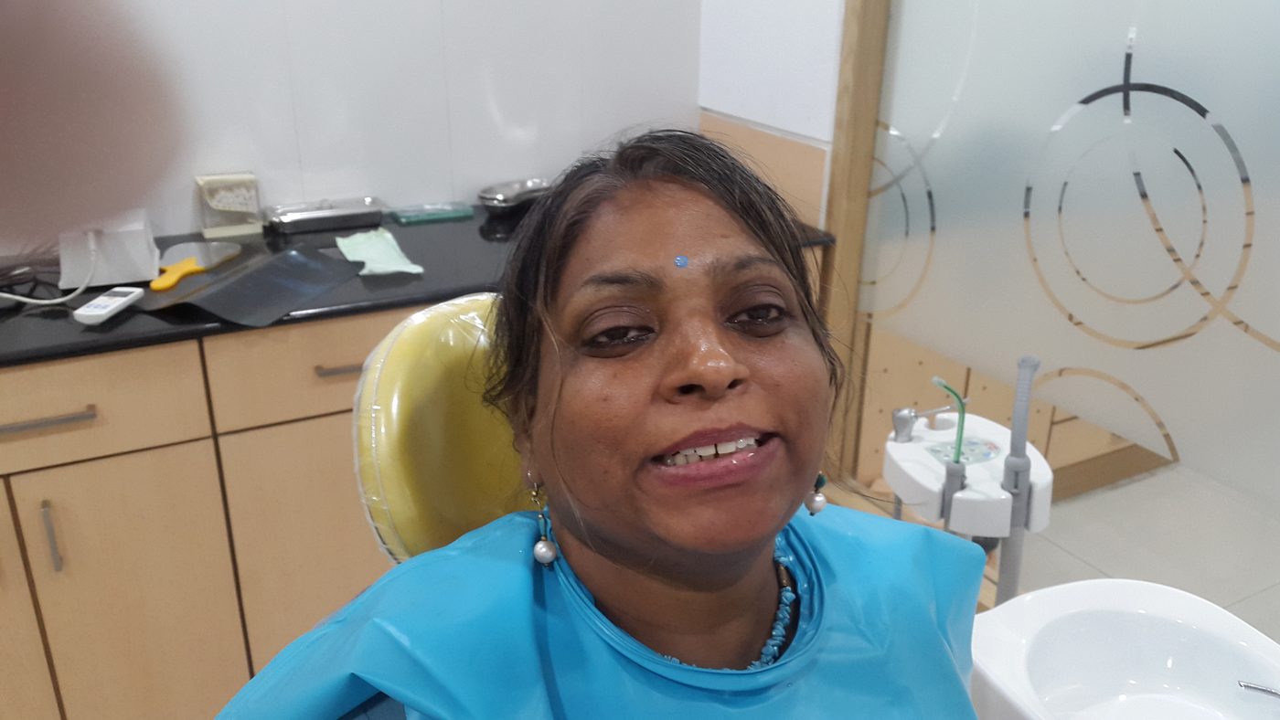 Client smile photo at Star Orthodontist Clinic